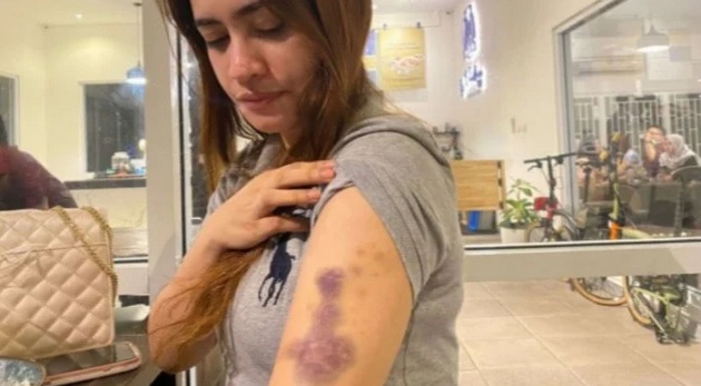 Fakta-fakta Polwan di Riau Aniaya Pacar Adiknya, Begini Nasibnya