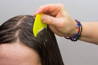 Awas, 4 Kebiasaan Ini Bisa Bikin Kutu Betah Nempel di Rambut