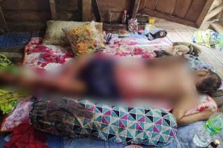 Warga Pulau Medang di Lingga Idap Penyakit Kulit Aneh, Sekujur Tubuh Penuh Luka-luka