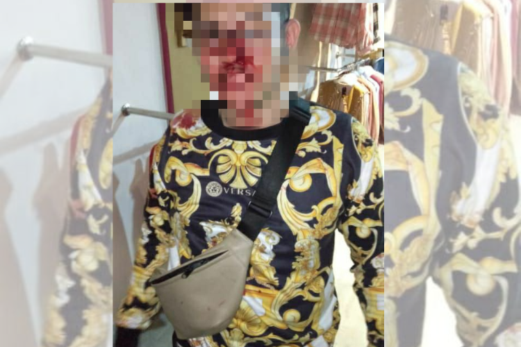 Aniaya Pemilik Fotokopi, Karyawan Supermarket di Tanjungpinang Diciduk Polisi