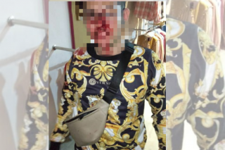 Aniaya Pemilik Fotokopi, Karyawan Supermarket di Tanjungpinang Diciduk Polisi