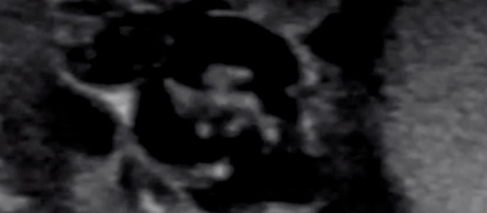 Duh! Video Parasit Goyang-goyang di Kantung Pelir Seorang Pria