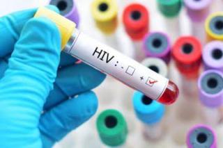 Ketahui 4 Cara Penyebaran HIV/AIDS yang Harus Diwaspadai