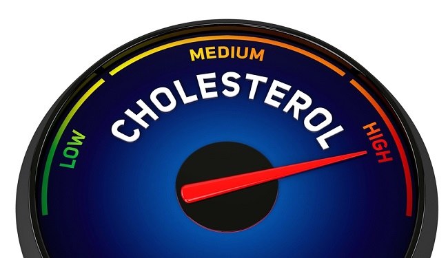 Ciri-ciri Kolesterol Tinggi yang Perlu Diwaspadai, Jangan Tunggu Sampai Parah!