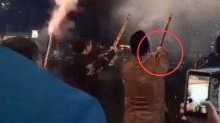 Jari Wakil Bupati di Bengkulu Hancur Terkena Ledakan Kembang Api saat Rayakan Tahun Baru