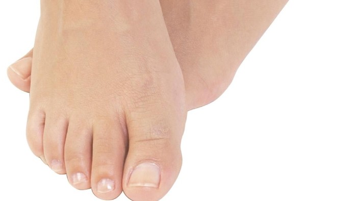 Sinyal Kolesterol Tinggi yang Terlihat dari Kuku Kaki