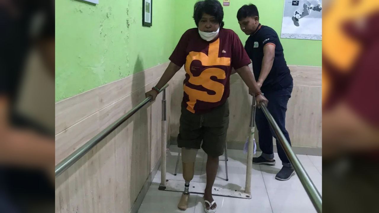 Suti Karno Belajar Pakai Kaki Palsu usai Diamputasi Akibat Diabetes
