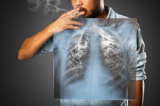 Waspada, Rokok Jadi Faktor Utama Kanker Paru-paru Pada Laki-laki di Indonesia