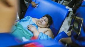 Deretan Kasus Obesitas Ekstrem di Indonesia, Ada yang Bobot 350 Kilogram