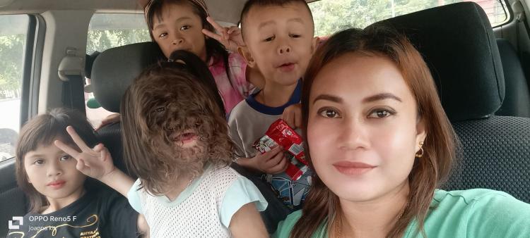 Balita dengan Kondisi Langka, Kisah "Anak dari Surga" Diadopsi Ratu Malaysia
