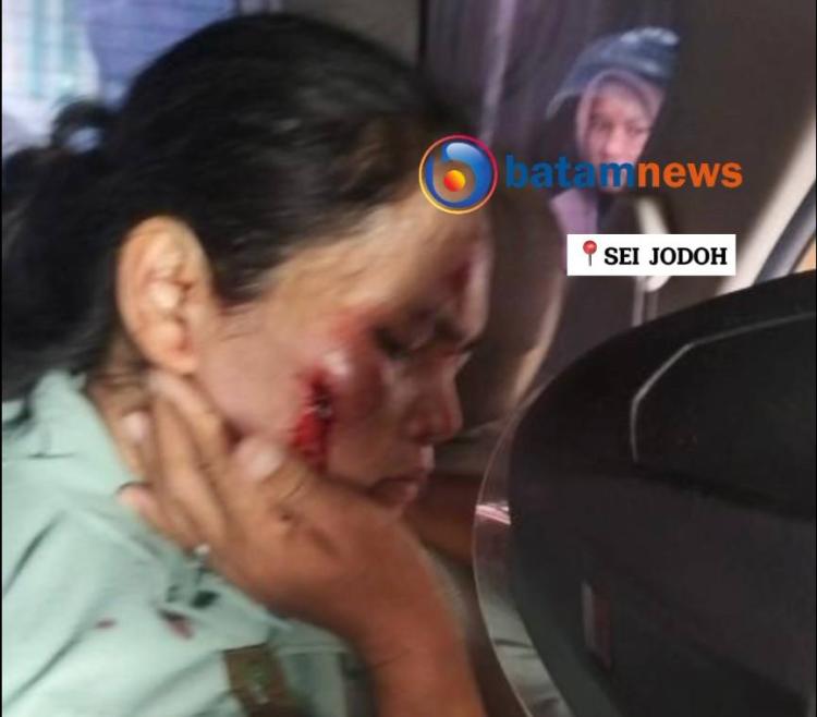 Kondisi Terkini Ibu Rumah Tangga Jadi Korban Jambret di Batam, Pelaku Belum Ditemukan