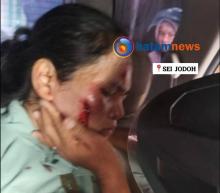Kondisi Terkini Ibu Rumah Tangga Jadi Korban Jambret di Batam, Pelaku Belum Ditemukan