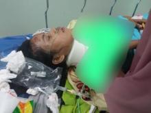 Jadi Korban Tabrak Lari Sopir Truk Ugal-ugalan, Sekuriti Wanita di Batam Luka Parah