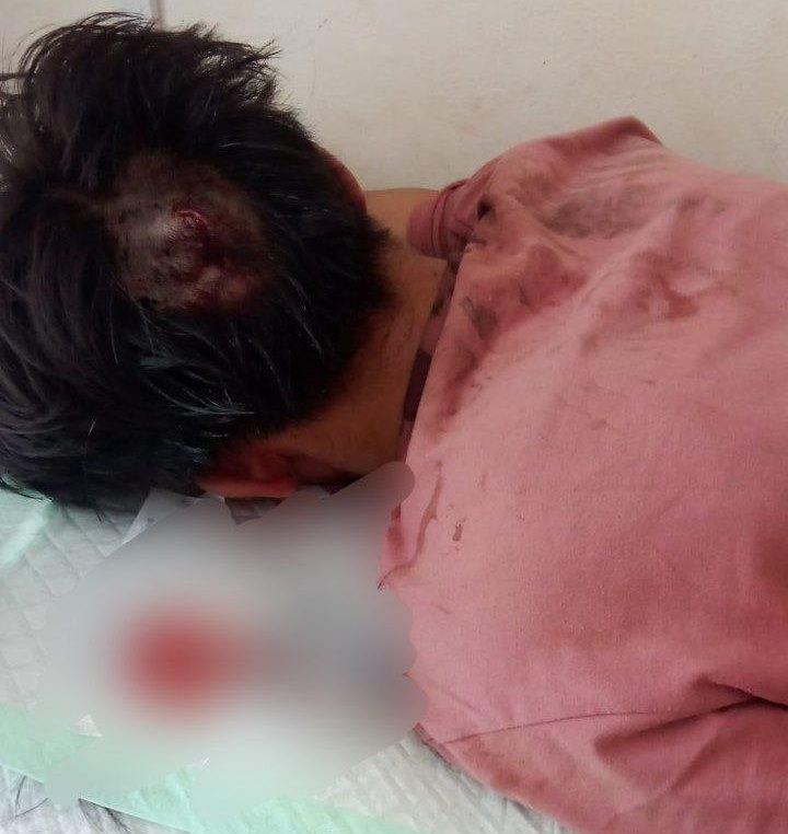 Pria Dibuang ke Hutan Setelah Dibegal di Jalan Mata Kucing Batam, Motor dan Barang Berharga Raib