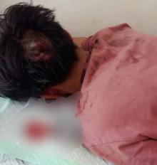 Pria Dibuang ke Hutan Setelah Dibegal di Jalan Mata Kucing Batam, Motor dan Barang Berharga Raib