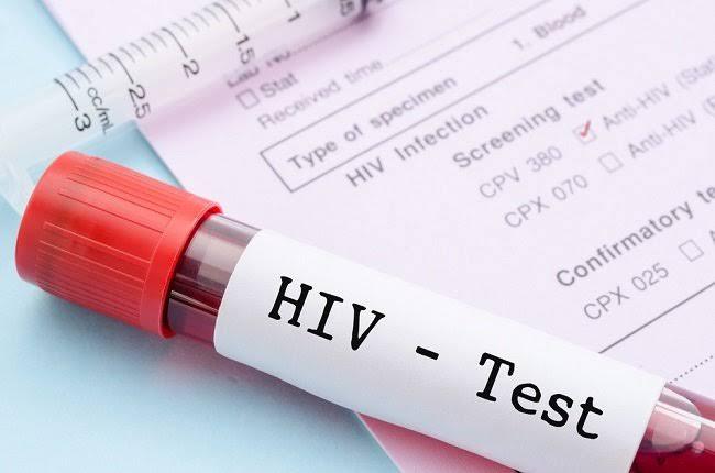 Dinkes Batam Catat 527 Kasus Baru HIV dari Januari hingga Agustus 2024, Didominasi Kaum Pria