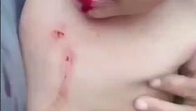 Viral Video Balita di Batam Dianiaya, Ibu Kandung Diduga Alami Gangguan Jiwa