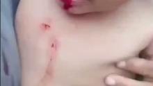 Viral Video Balita di Batam Dianiaya, Ibu Kandung Diduga Alami Gangguan Jiwa