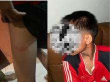 Tiga Pelajar SMP Disekap dan Dianiaya oleh Sekuriti Kawasan Botania II Usai Dituduh Mencuri