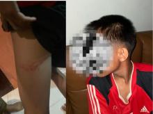 Aniaya Tiga Remaja SMP, Sekuriti di Batam Resmi Jadi Tersangka