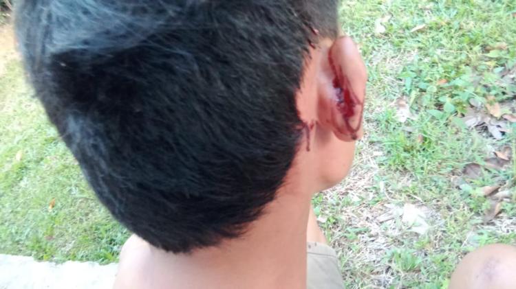 Muhammad Abdullah, Pedagang Tisu Viral, Laporkan Penganiayaan ke Polisi - Ini Fakta Terbaru