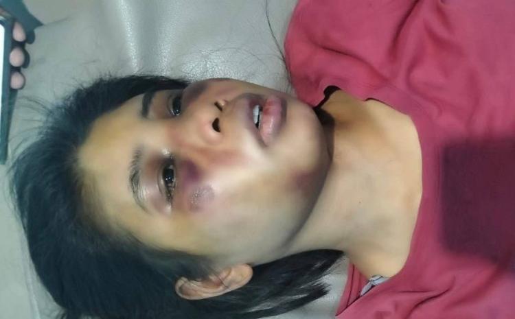 Disiksa Majikan di Batam, Intan ART Asal Sumba Dipukul, Ditendang di Area Sensitif
