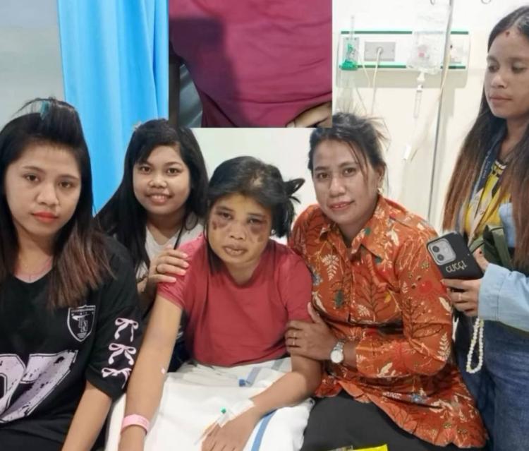 Ketua STTI Kupang Tawarkan Beasiswa Penuh untuk Intan, Korban Penyiksaan Majikan di Batam