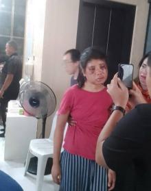 ART Dianiaya di Perumahan Elit Sukajadi Batam, Majikan Kabur Saat Didatangi Tim Flobamora