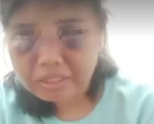 ART Dianiaya Majikan di Perumahan Elit Batam, Wajah Lebam dan Trauma Psikis