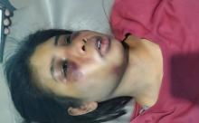 Disiksa Majikan di Batam, Intan ART Asal Sumba Dipukul, Ditendang di Area Sensitif