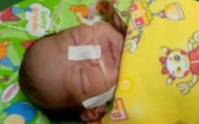 Adik Elsa Padilla, Bayi 6 Bulan Asal Anambas, Butuh Uluran Tangan untuk Berjuang Melawan Penyempitan Jantung