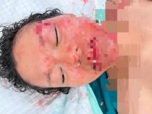 Dua Perempuan Muda Kritis Usai Kecelakaan di Simpang Kepri Mall Batam
