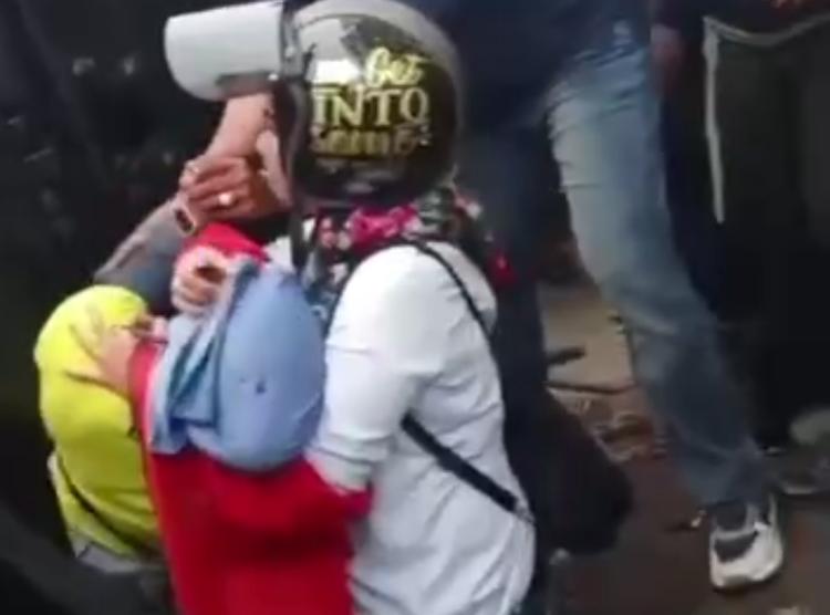 Kaki Fatmawati Terancam Diamputasi Usai Tertimpa Rantai Alat Berat di Batam