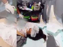 Warga Batam Diincar, Pegawai Kafe Disiram Air Keras Saat Mau Berangkat Kerja
