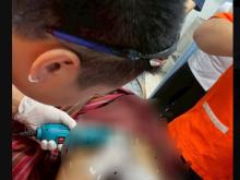 Pria Kunci Penisnya Karena Takut Dicuri, Bengkak Sebesar Kepalan Tangan