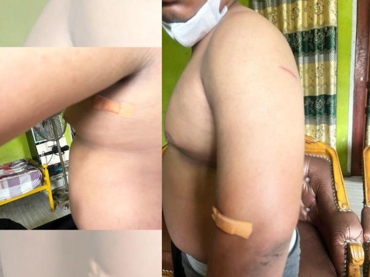 Warga Batam Dikeroyok dan Ditusuk Gunting Gara-gara Tak Kasih Uang ke Pengamen