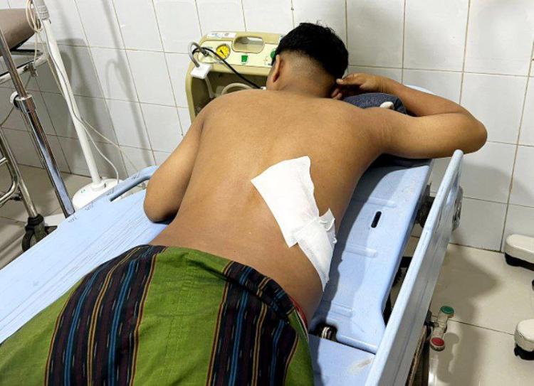 Korban Penusukan di Batu Aji Ternyata Dikerjai Teman Sendiri