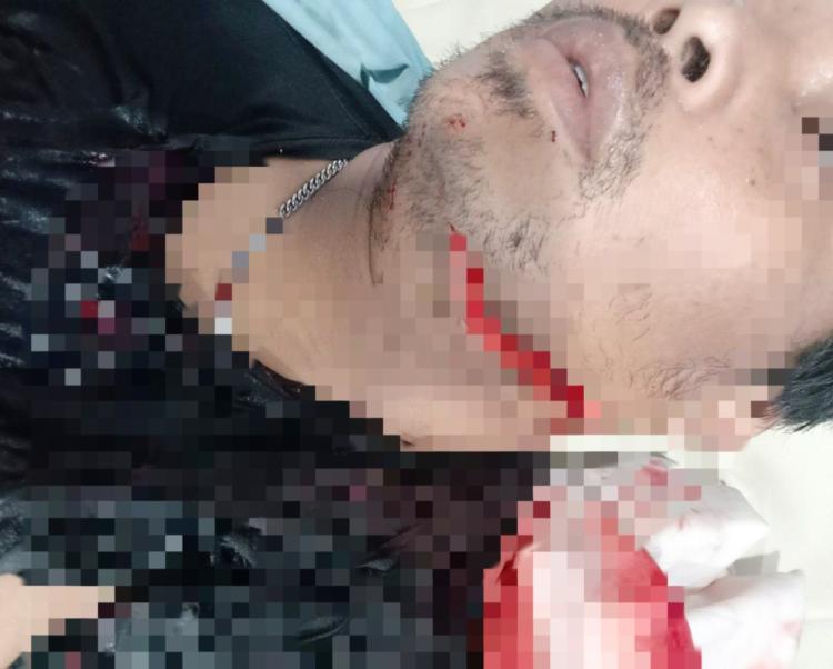 Pelaku Penganiayaan di Pasar Baru Tanjung Uma Ditangkap, Korban Alami 52 Jahitan