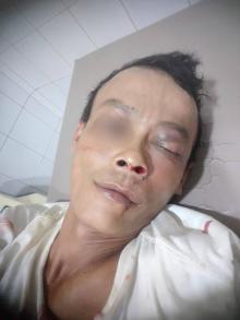 Polisi Selidiki Pengeroyokan Pengunjung King Club Batu Aji Hingga Tak Sadarkan Diri