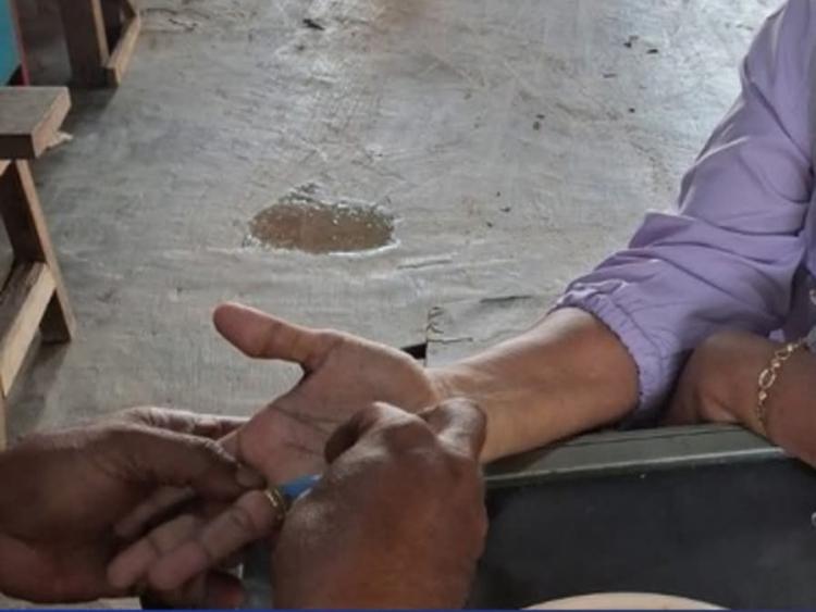 Damkar Lingga Evakuasi Cincin Tersangkut di Jari Warga Dabo