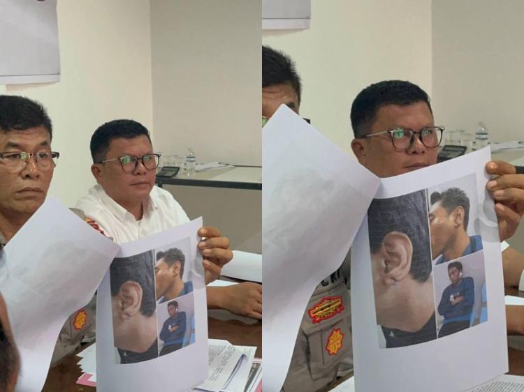 Polisi Sebut Yehezkiel Buat Ribut hingga Terlibat Perkelahian, Kuasa Hukum Bantah Kliennya Memukul Dulu