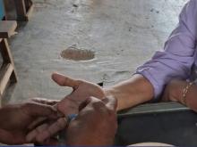 Damkar Lingga Evakuasi Cincin Tersangkut di Jari Warga Dabo